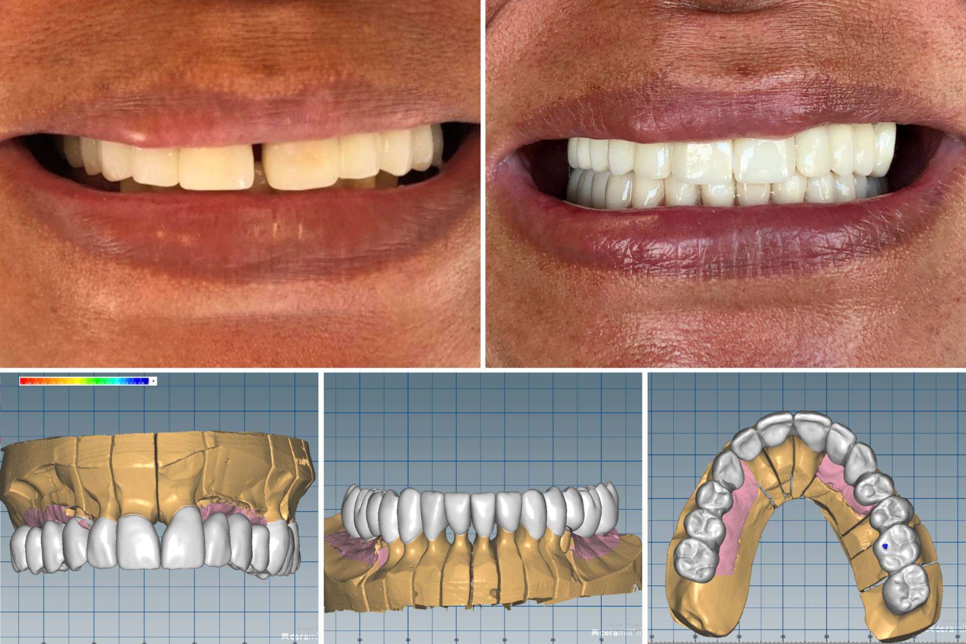 Clínica Dental Zavala, odontología avanzada en Lima