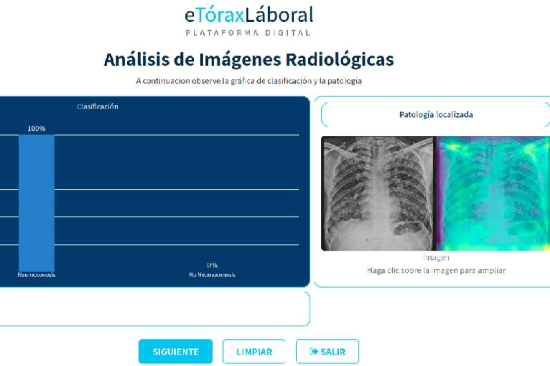 Convicción Digital presenta la plataforma eTóraxLaboral para la detección de enfermedades respiratorias