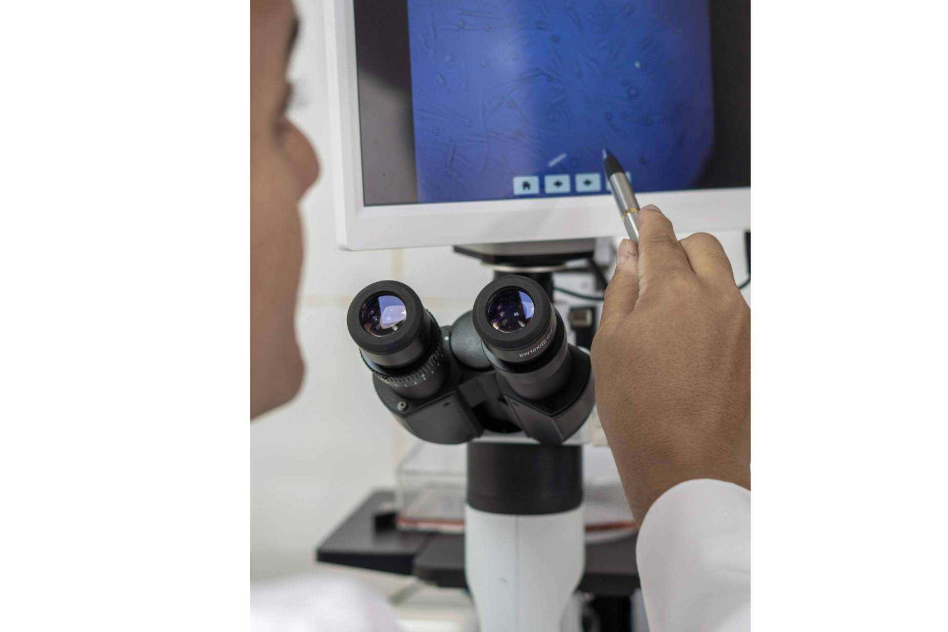 Cancer avanzado; El valioso aporte actual de la inmunoterapia DEX en el tratamiento personalizado del cáncer